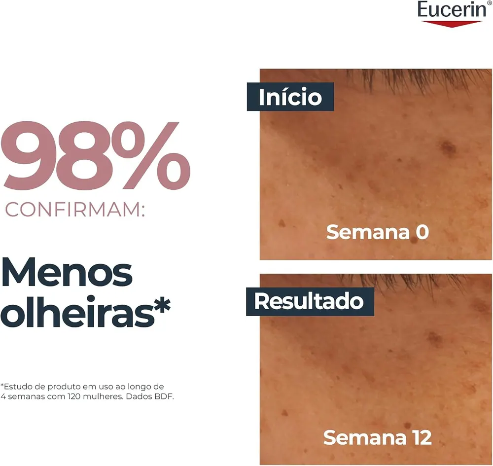 Eucerin Anti-Pigment Creme Área dos Olhos Clareador de Olheiras 15ml
