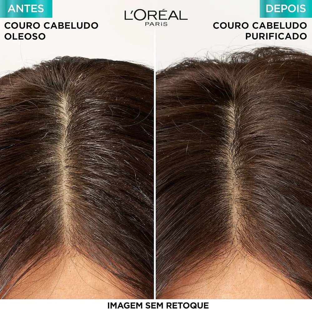 L'Oréal Paris Elseve Pure Hialurônico Shampoo Hidra Purificante 400ml