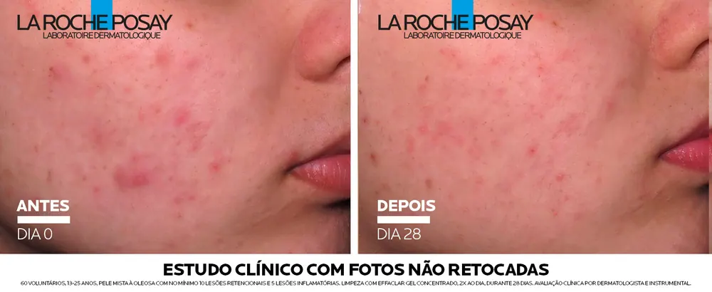 Effaclar Gel Concentrado