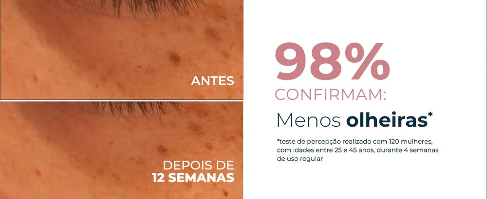 Fórmula com Thiamidol