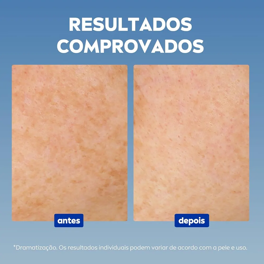 NIVEA Luminous 630 Sérum Avançado Antimarcas Escurecidas 30ml