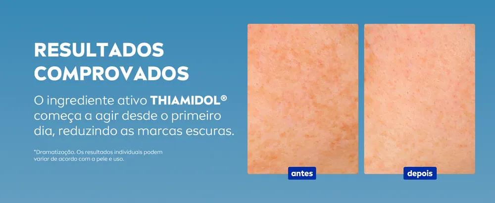 Thiamidol começa a agir desde o primeiro dia
