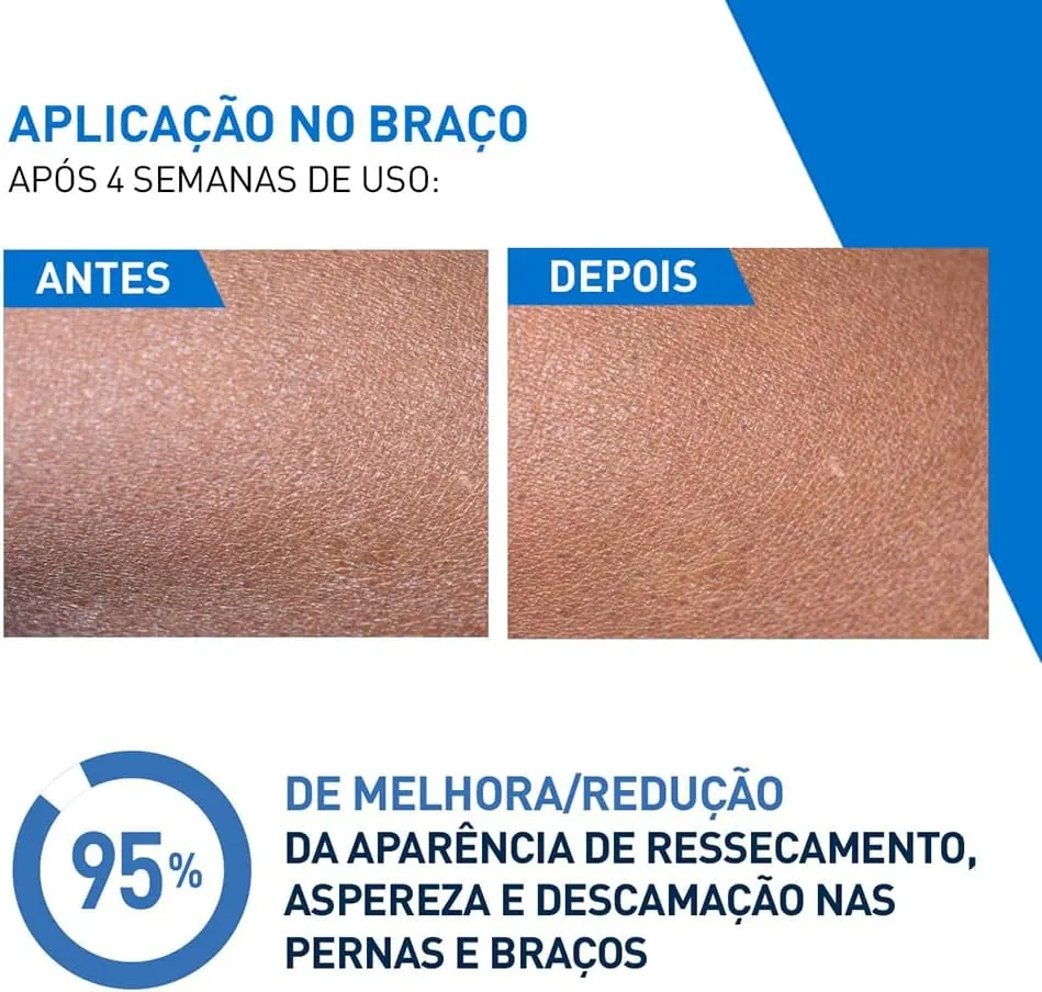 CeraVe Loção Hidratante Intensiva com Ureia Sem Perfume 200ml