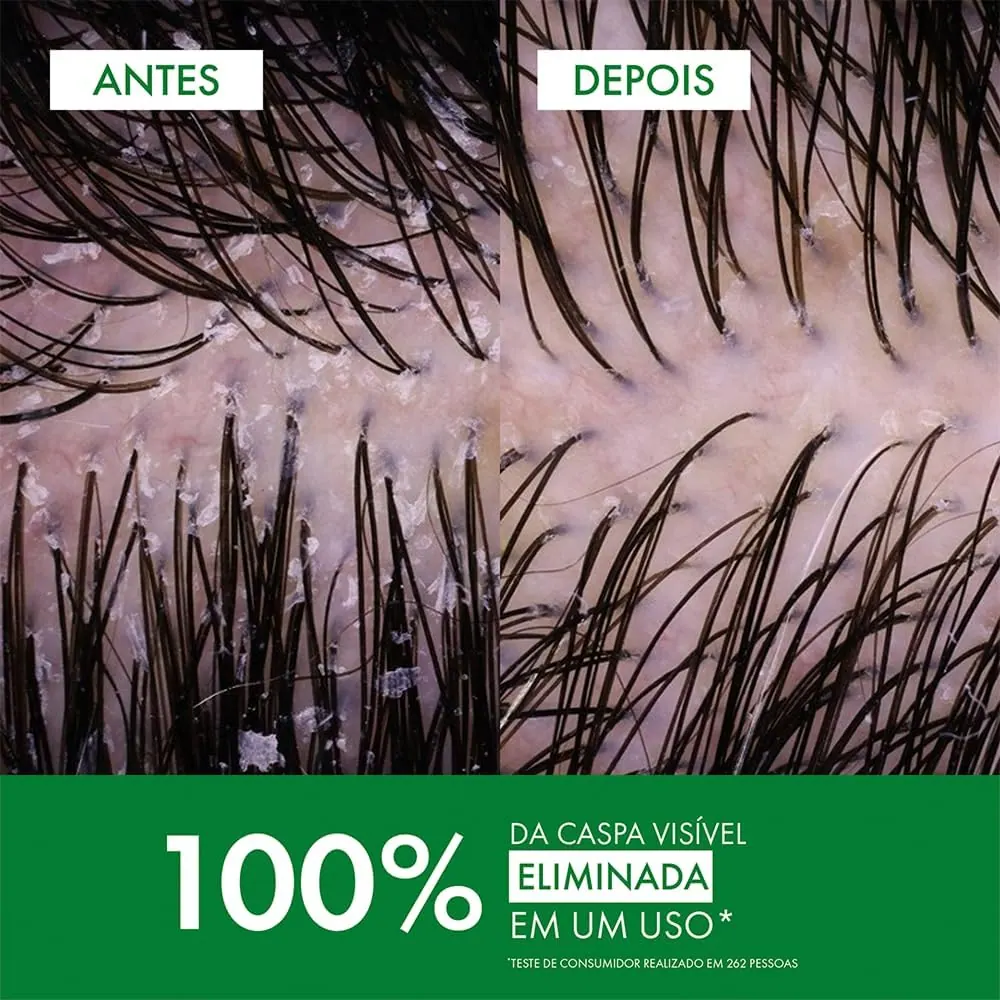 Vichy Dercos Shampoo Anticaspa DS para Cabelos Normais a Oleosos