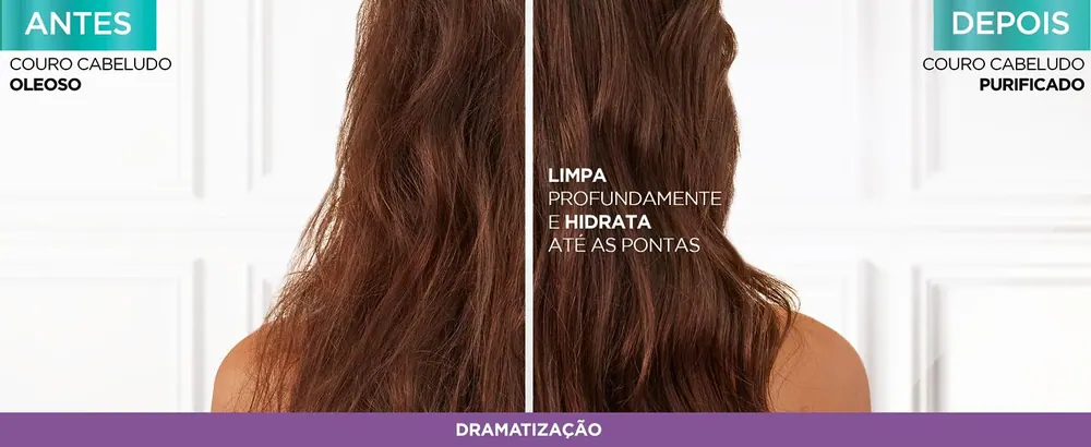 Antes e depois do uso de Elseve Pure Hialurônico