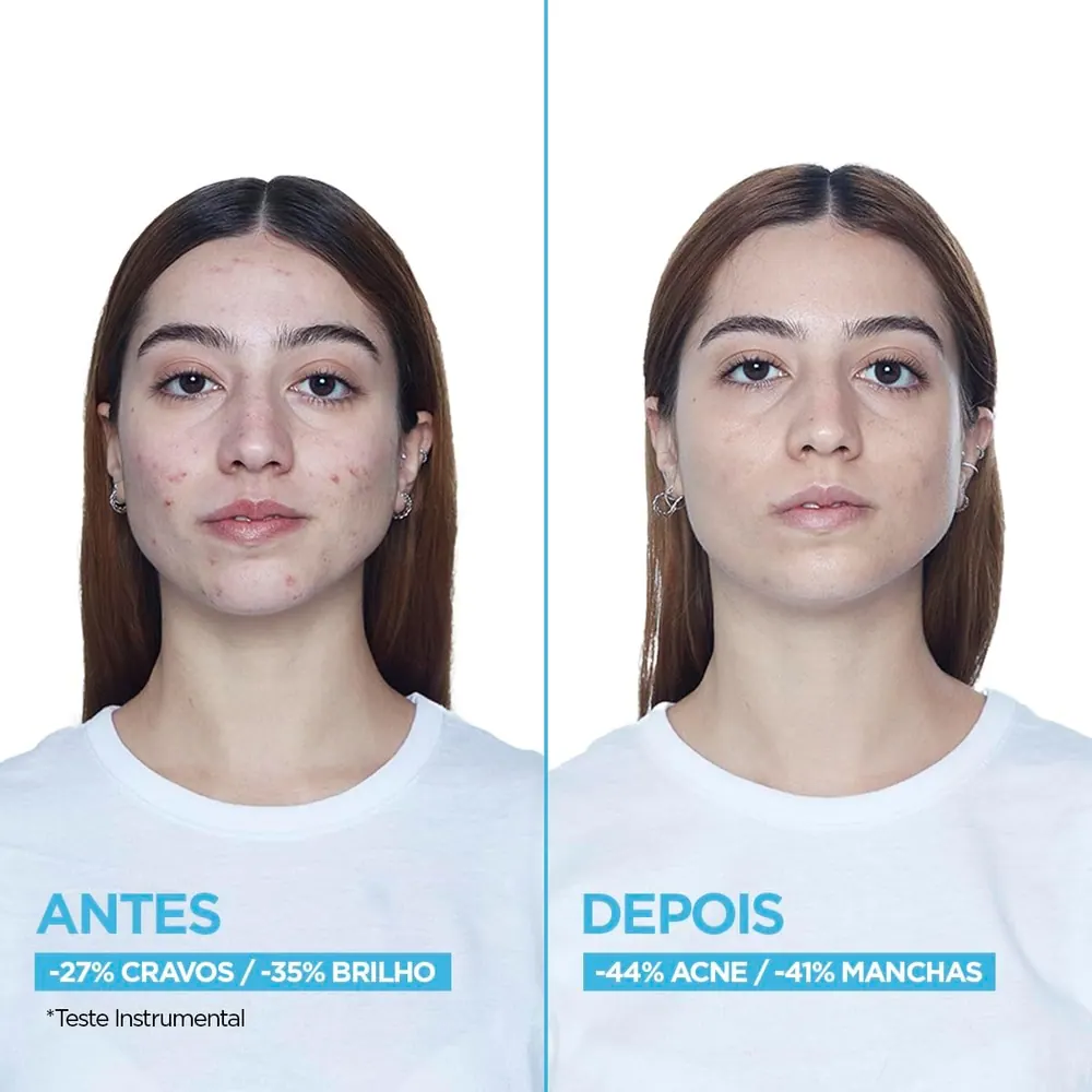 Garnier Uniform & Matte Sérum Facial Antiacne 15ml