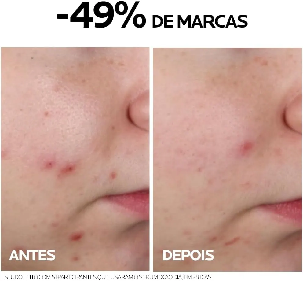 La Roche-Posay Effaclar Sérum Ultra Concentrado 15ml