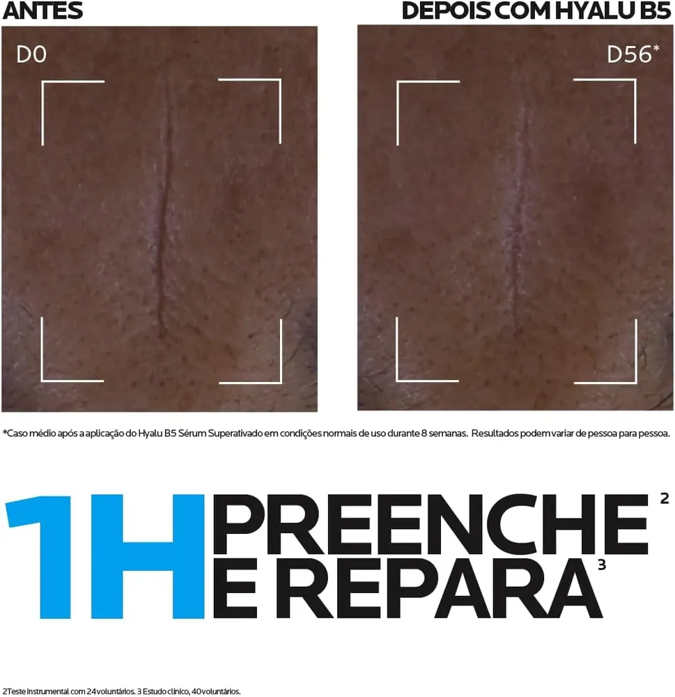 La Roche-Posay Hyalu B5 Sérum 30ml