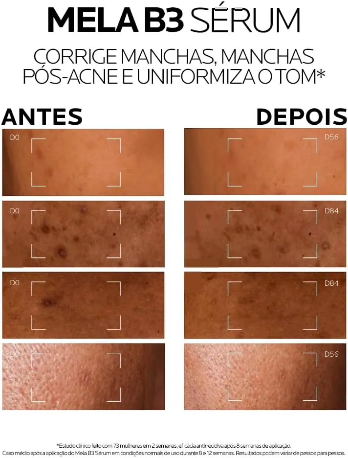 La Roche-Posay Mela B3 Sérum Facial Uniformizador com Melasyl e 10% de Niacinamida